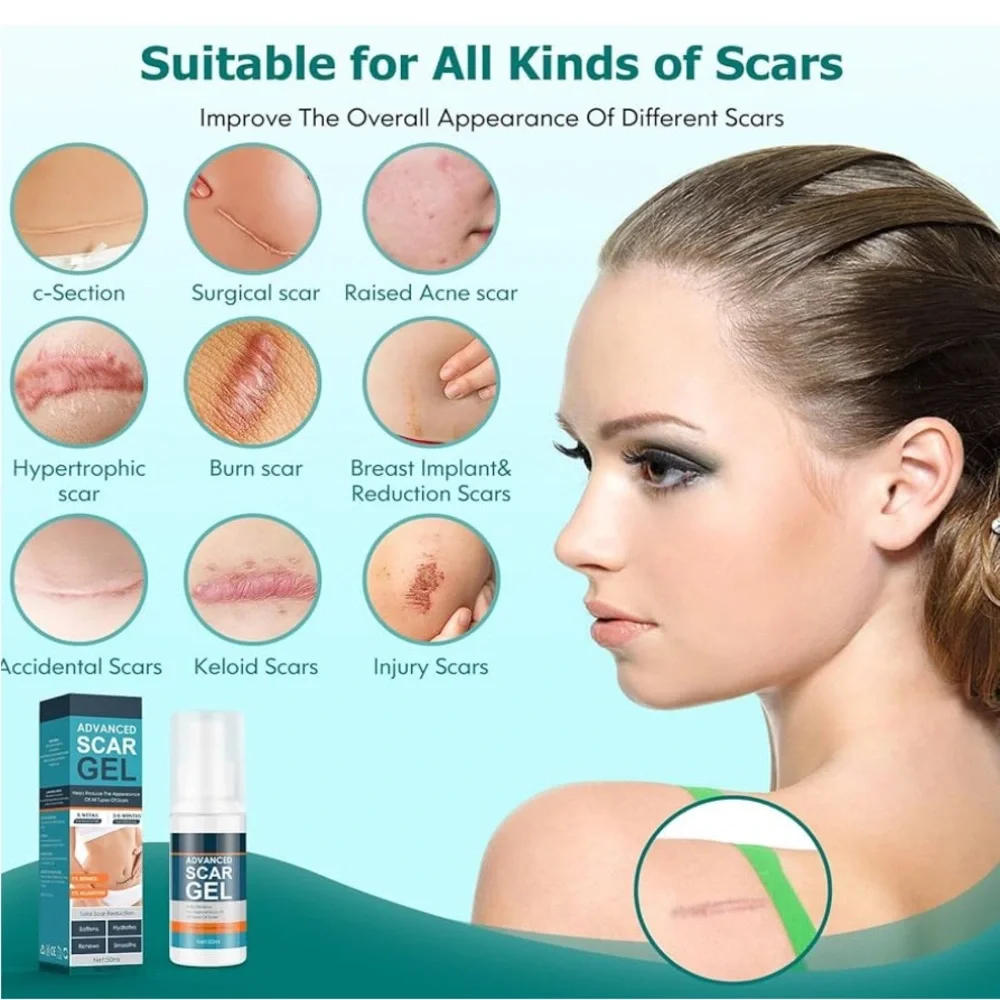 Lot of 2 – Gowgaw Advanced Scar Gel (1.76oz Each, New & Sealed)